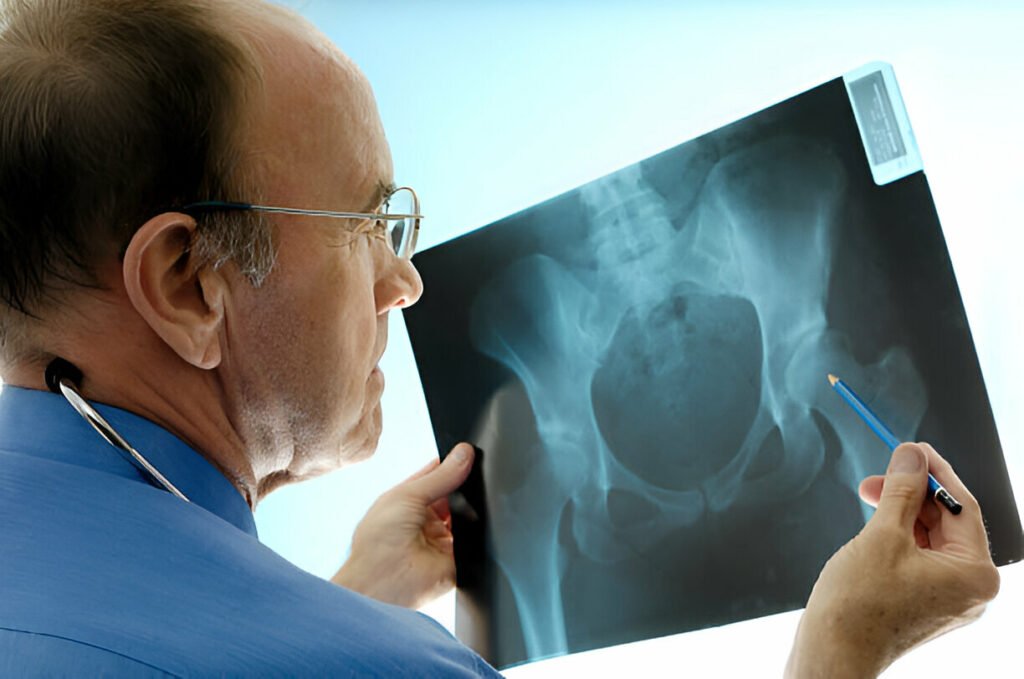 Total Hip Replacement