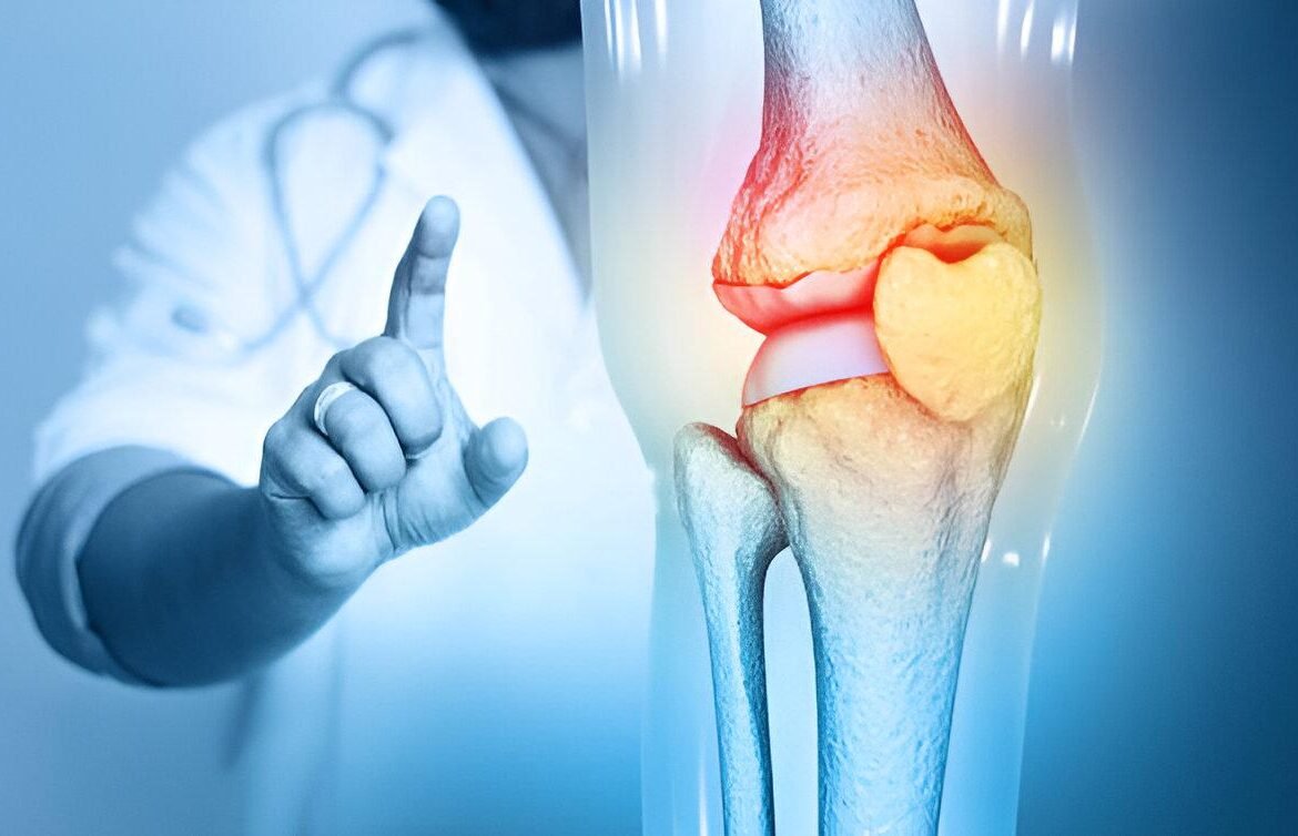 Osteo Arthritis Treatment in Mohali