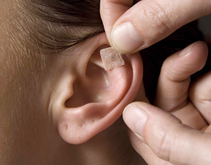 Auricular Therapy Treatment