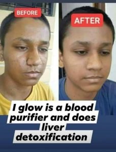 Physiotherapist in Kharar