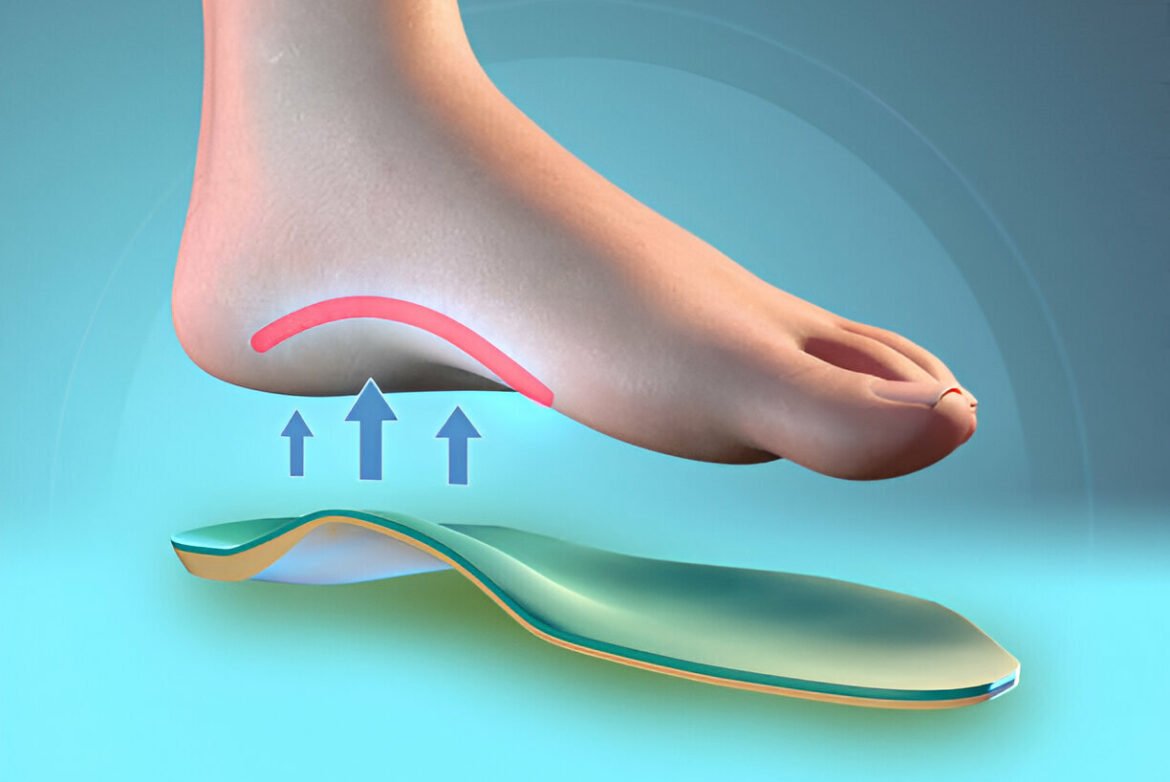 Plantar Fasciitis