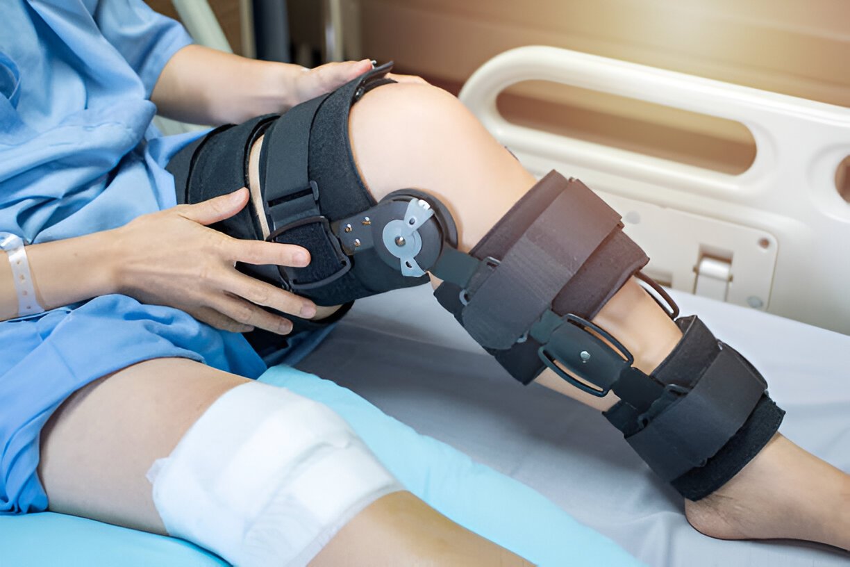 ACL injury rehabilitation