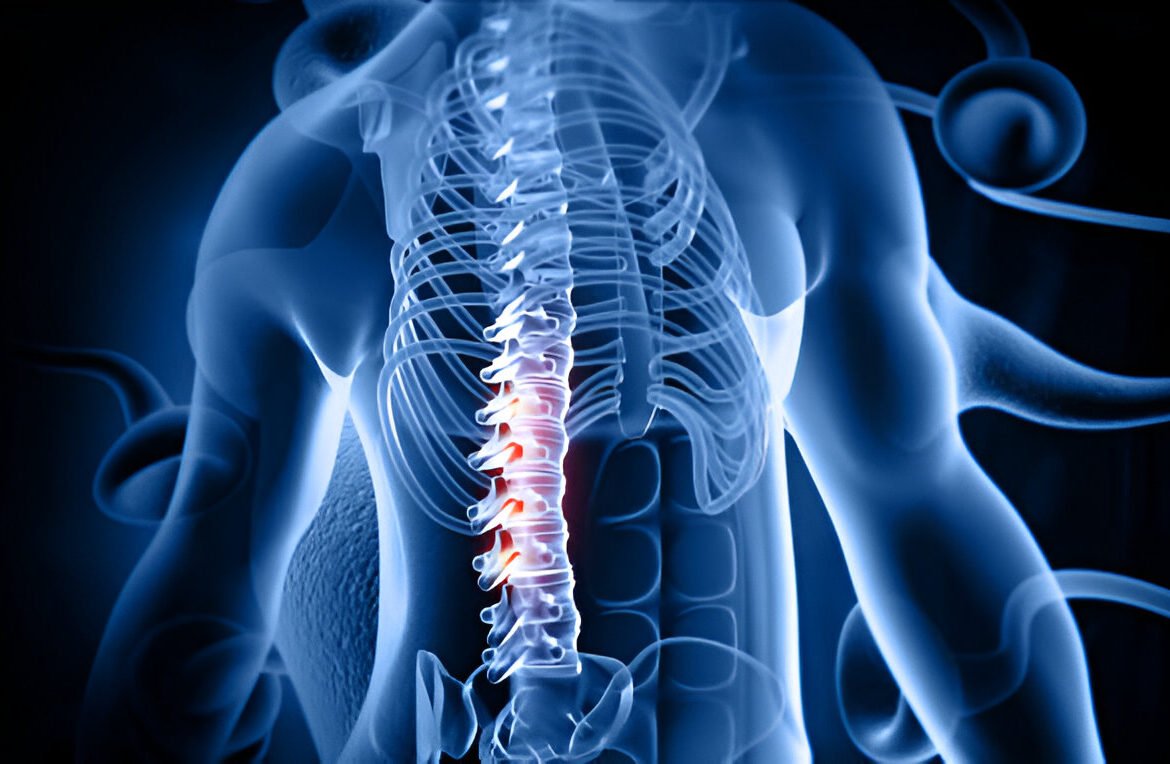 Disc bulge treatment