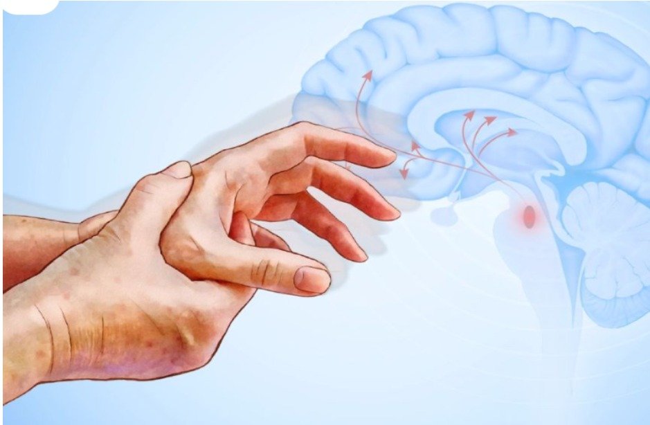 Parkinson’s Disease Specialist in Mohali
